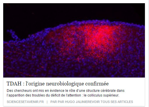 TDAH : l'origine neurobiologique confirmée